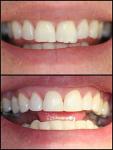 reshaping1_fs